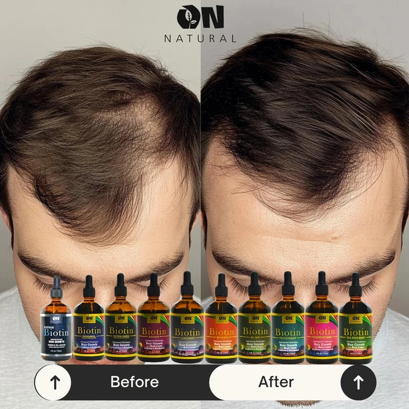 Next Image On Hair Growth Jamaican Black Castor Oil - 4 Oz 6 Next Image On Hair Growth Jamaican Black Castor Oil - 4 Oz - Image 4