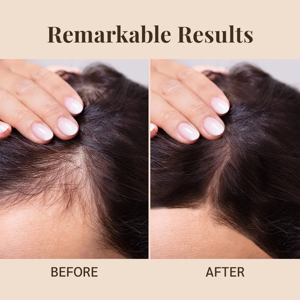 Well’s Batana Oil - 100% Natural & Cold-Pressed 2oz/4oz 14 Well’s Batana Oil - 100% Natural & Cold-Pressed 2oz/4oz - Image 12