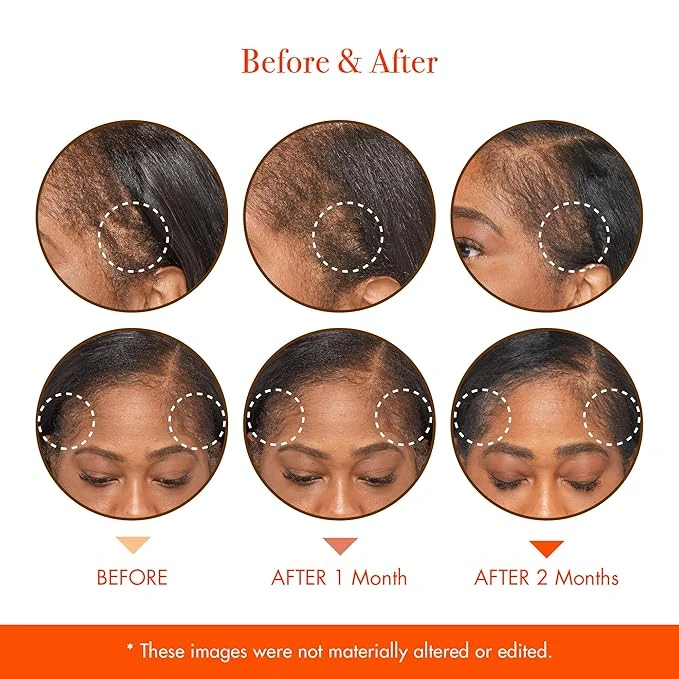 Red By Kiss Growth MD Scalp Serum - Biotin & Rosemary 2oz 7 Red By Kiss Growth MD Scalp Serum - Biotin & Rosemary 2oz - Image 5