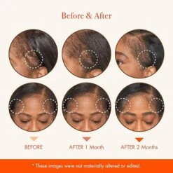 Red By Kiss Growth MD Hair & Scalp Oil - Nourish & Strengthen 2oz/4.5oz -Beauty Exchanges o4