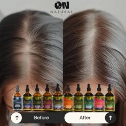 On Naturals Hair And Scalp Oil - 4 Oz -Beauty Exchanges on naturals hair scalp oil strength growth repair 2 variants 4 oz 171639 1