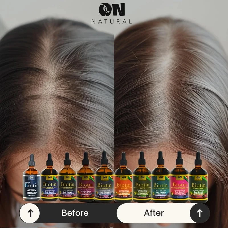 Next Image On Hair Growth Jamaican Black Castor Oil - 4 Oz 5 Next Image On Hair Growth Jamaican Black Castor Oil - 4 Oz - Image 3